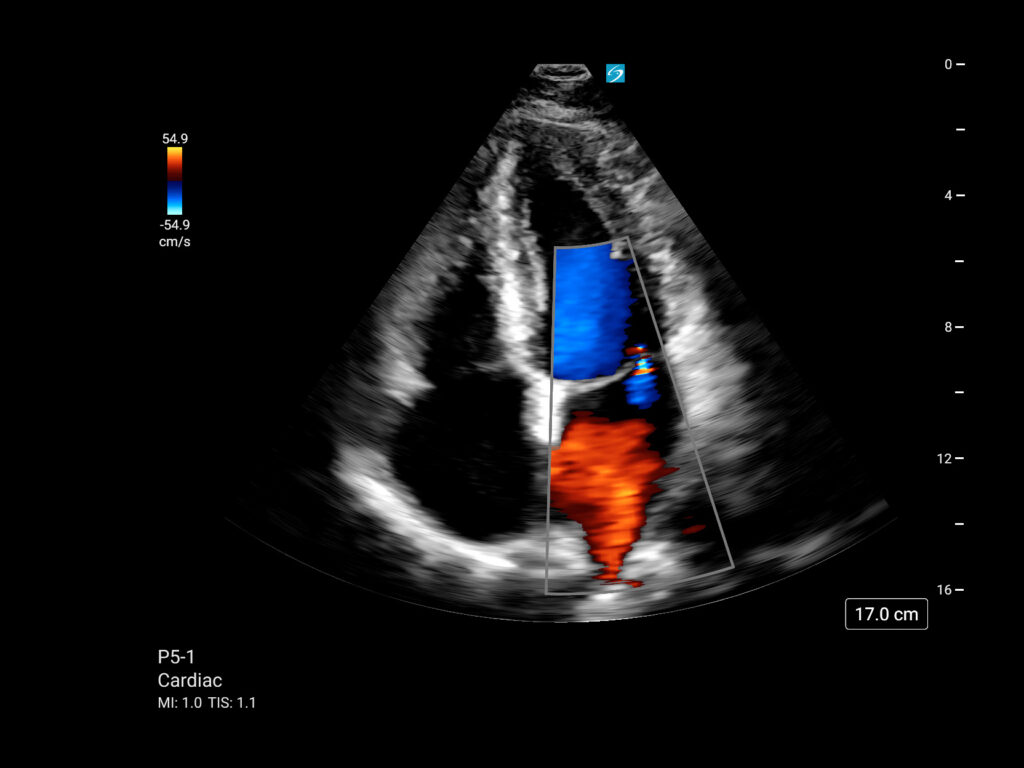 mt p5 1 cardiac a4c color