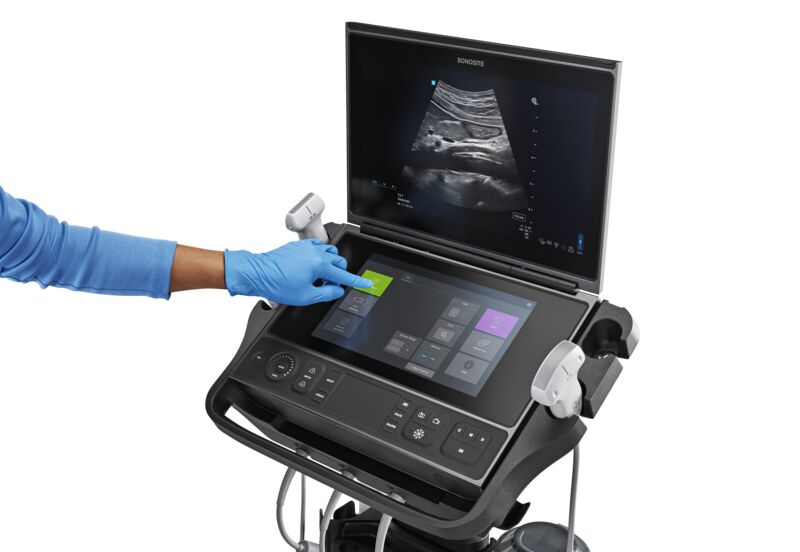 sonosite px system hand c5 1 abdominal aorta gastric antrum