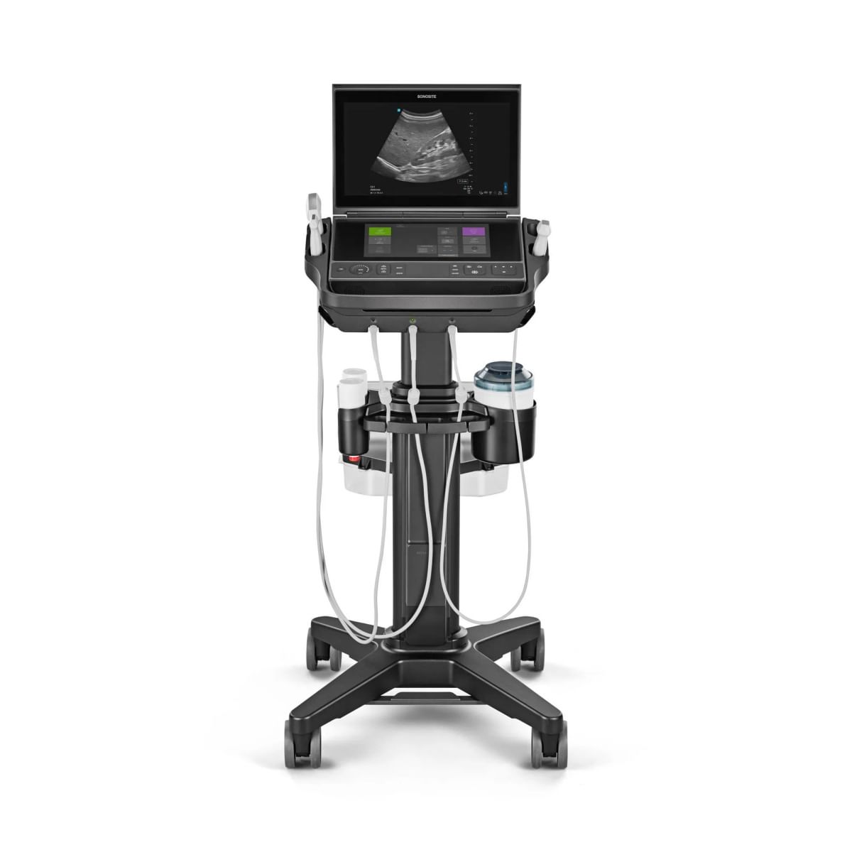 sonosite px system right upper quadrant