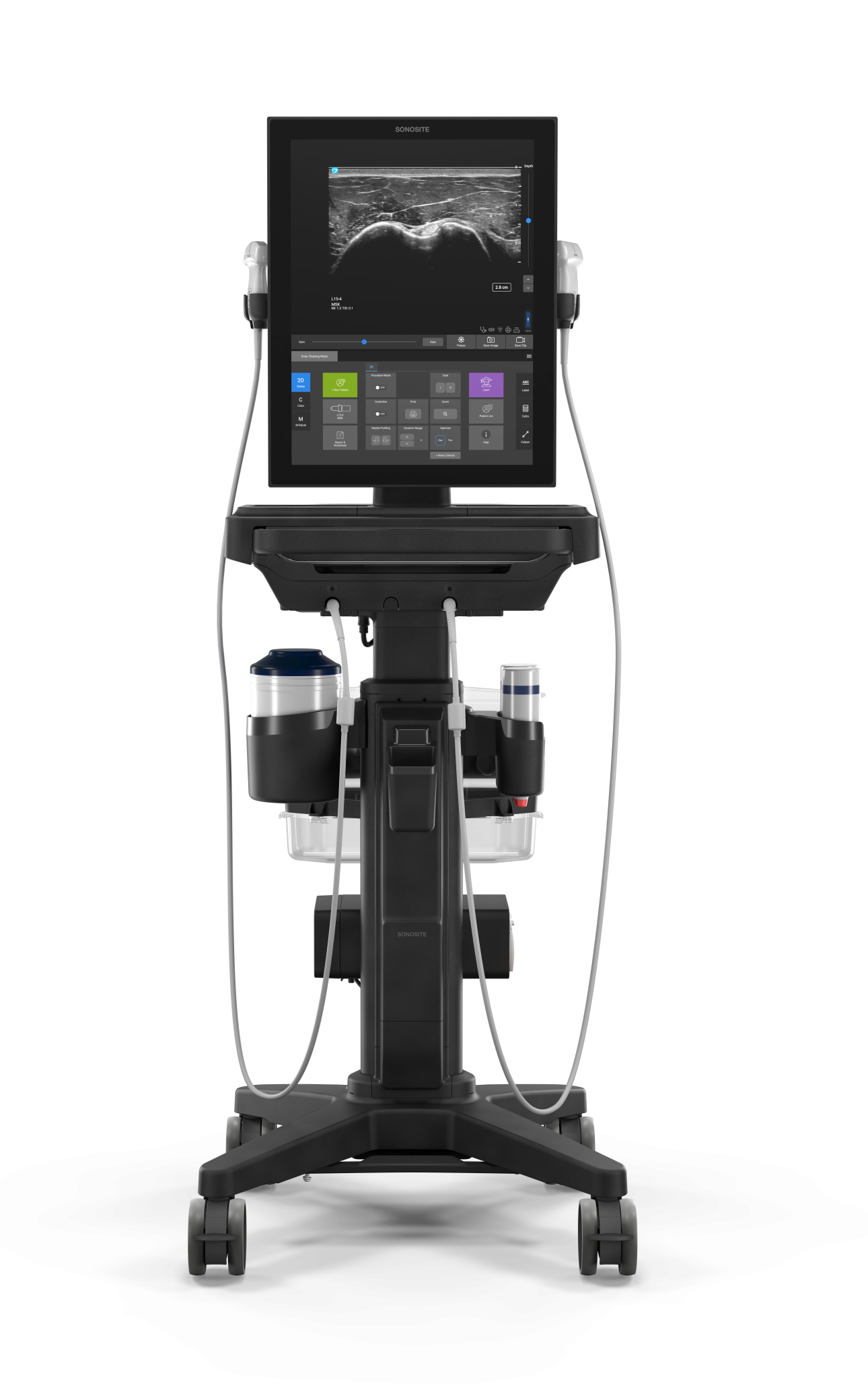 Sonosite ST ANESTHESIA