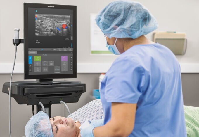 sonosite st l15 4 anesthesia nerve interscalene color