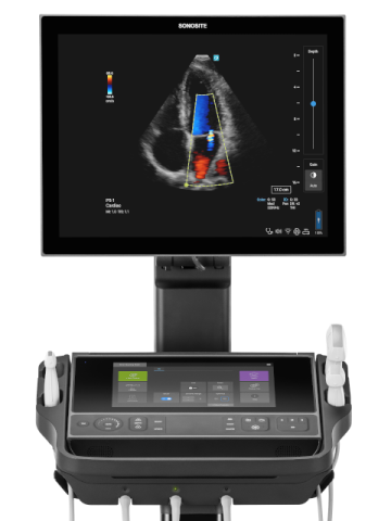 Sonosite LX