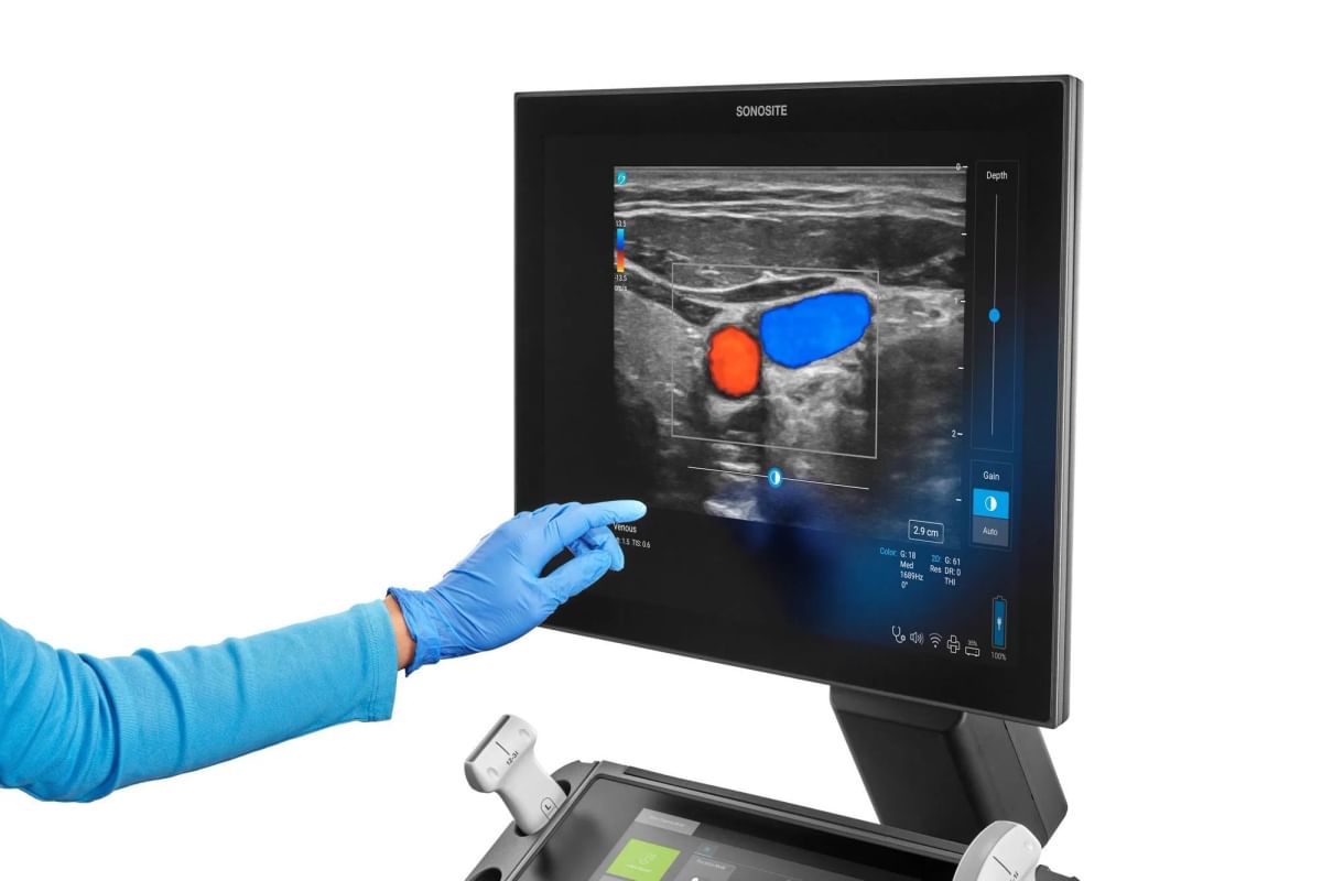 Sonosite LX Ultrasound system