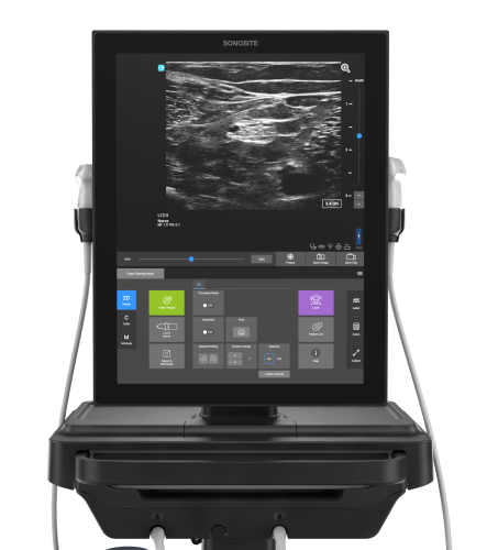 Sonosite ST SONOSITE ST